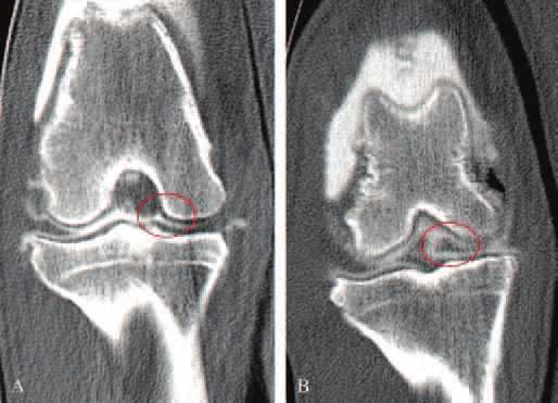 Due immagini Tac delle lesioni al Menisco Mediale di un Boxer ( area cerchiata )