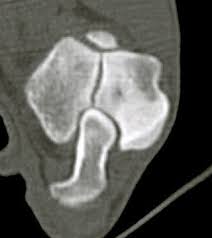 Immagine Tac della lesione in uno Springer Spaniel