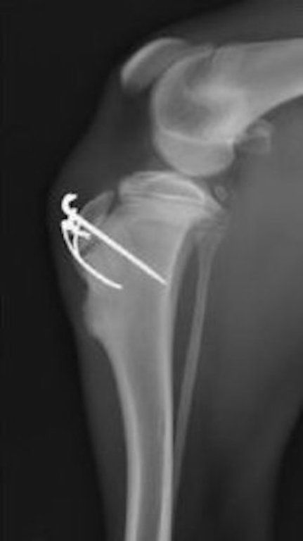 Radiografia Post-Operatoria del ginocchio del cane Milo