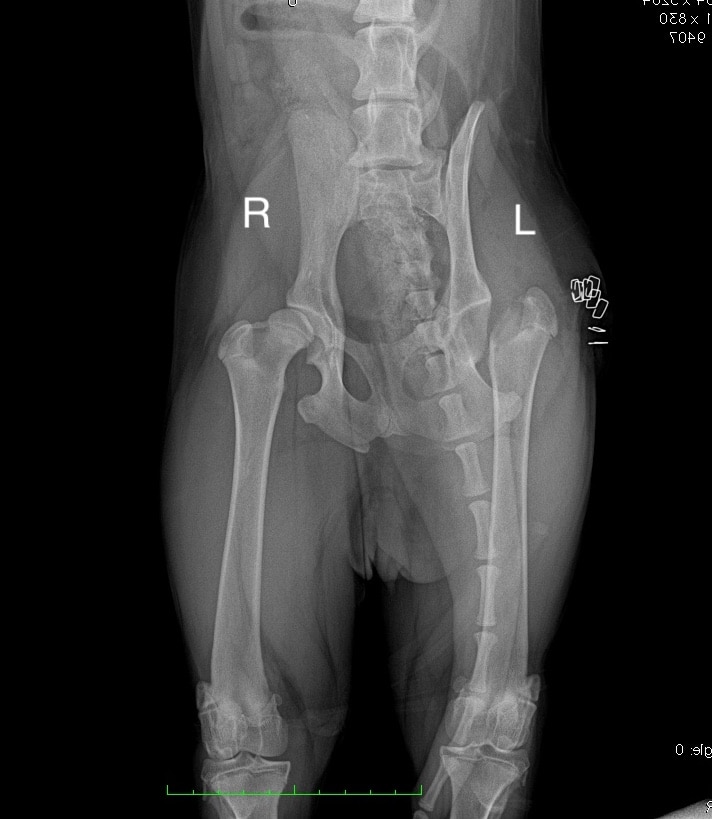 foto di una protesi d'anca dopo l'intervento di Ostectomia della Testa del Femore